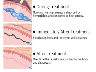 High Efficiency & Speed – 4000W power and 2Hz frequency for fast treatment sessions.